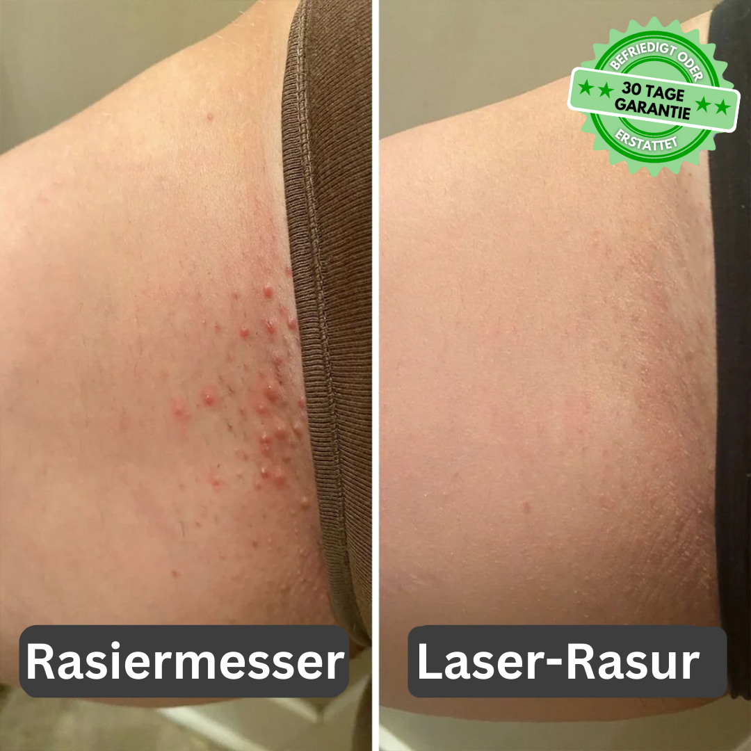 Luxurity™ - laserrasierer